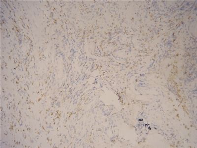 cd7+是什么意思 cd7